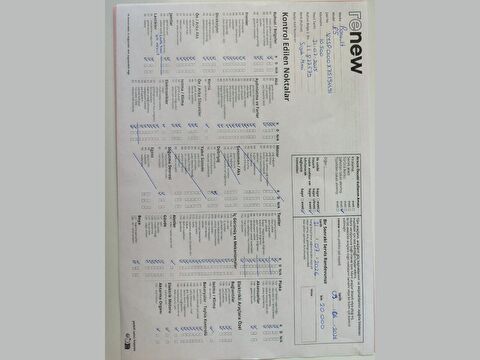 renault, r5 e-tech, r5 ev52 techno, otomatik, elektrik 2.el otomobil | renew 27